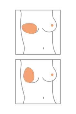 Amoena Teilprothese Balance Natura Thin Oval 6 Amoena Teilprothese Balance Natura Thin Oval -Dessous Geschäft Amoena Brustprothesen Form Oval min 1280x1280