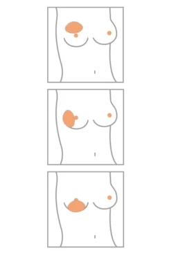 Amoena Teilprothese Balance Natura Special Varia 5 Amoena Teilprothese Balance Natura Special Varia -Dessous Geschäft Amoena Brustprothesen Form Varia min 1280x1280